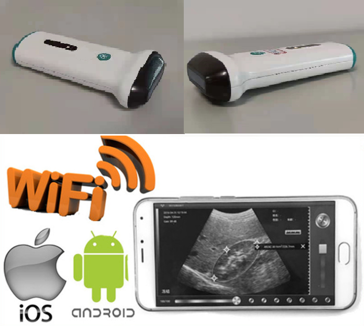 WIFI Protable Ultrasound Diagnostic system