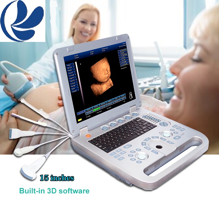 Protable Ultrasound Diagnostic system