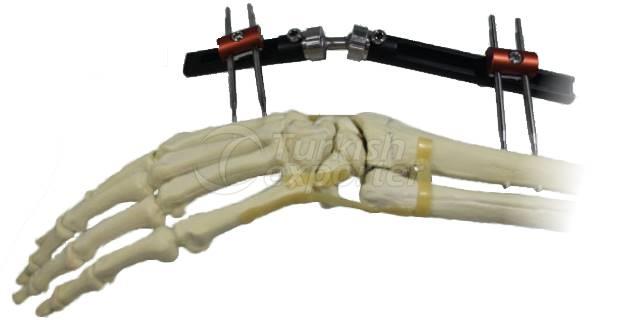 Monolateral Wrist Fixator