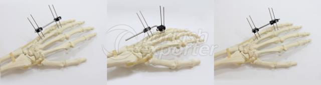 Mini Tubular Fixator System