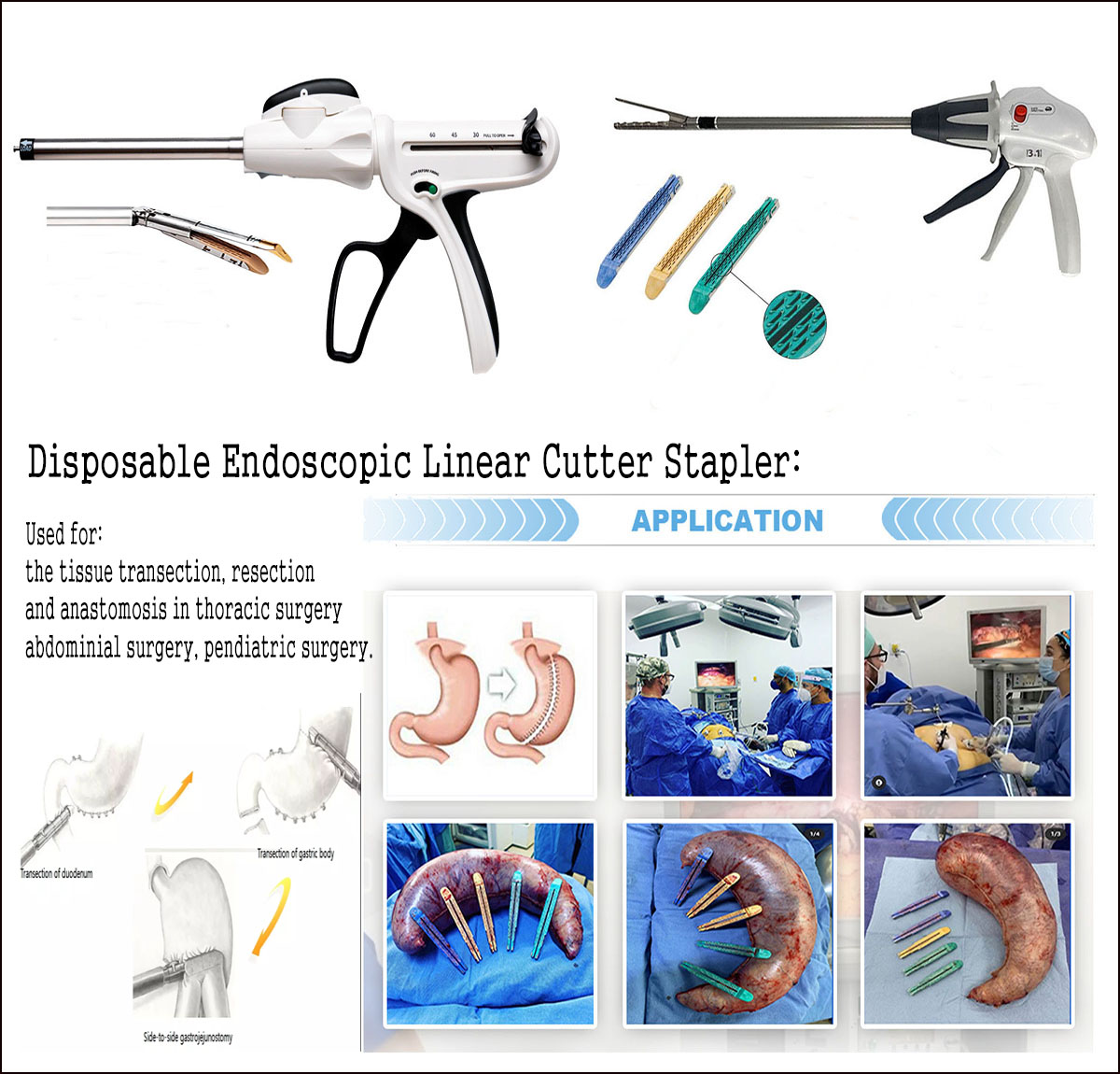 Disposable Endoscopic Linear Cutter Staplers and Reloads